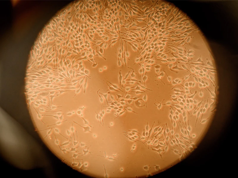Microscopic view of elongated, light orange cells on a darker orange background.